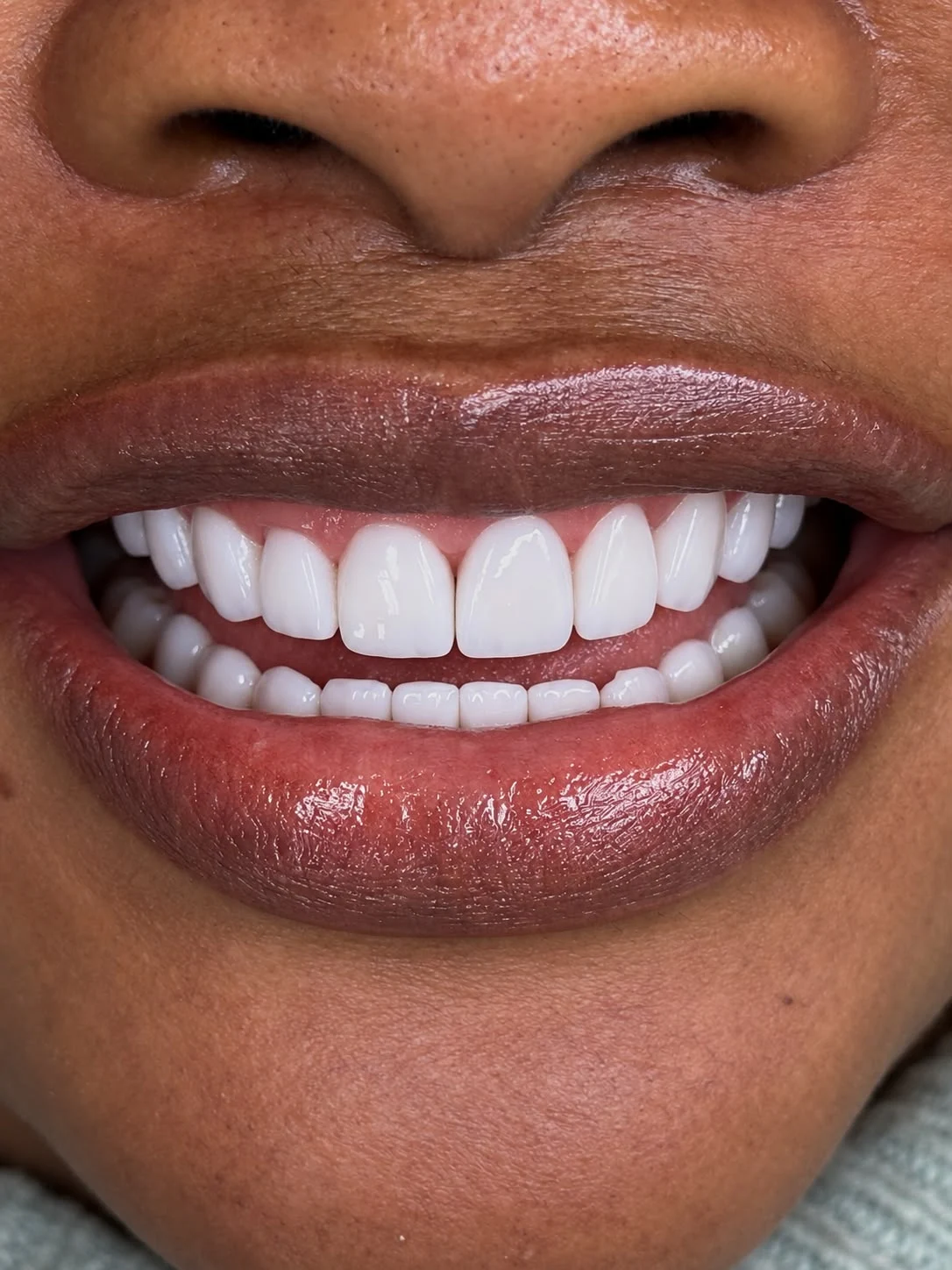 Sonrisa del portafolio de Galab
